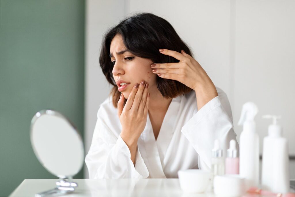 Perché l’acne a volte peggiora quando si inizia un trattamento anti-imperfezioni?