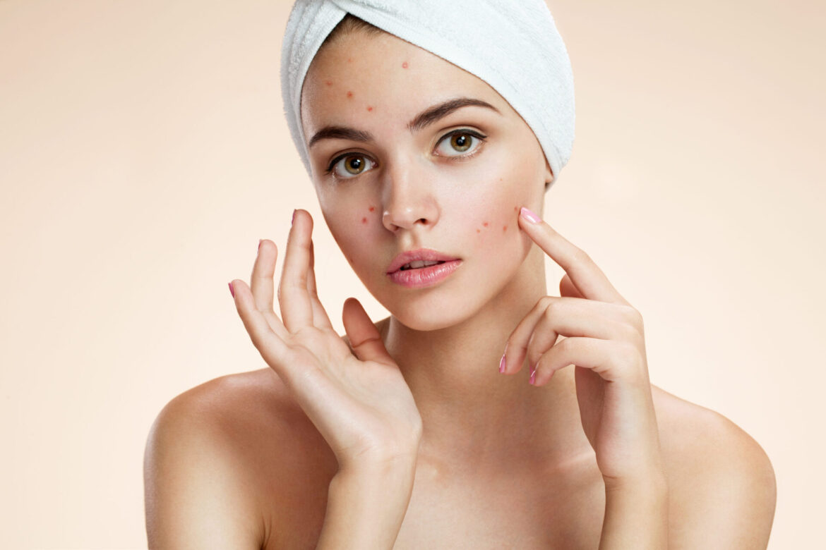 Face mapping